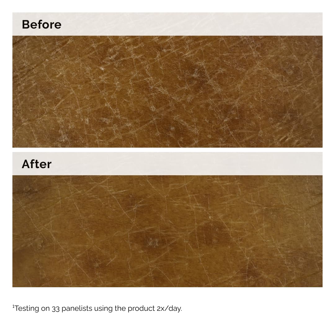 The Ordinary Natural Moisturizing Factors + Inulin Body Lotion, Lightweight Hydration for All-Day Moisture & Skin Barrier Support, 8.1 Fl Oz